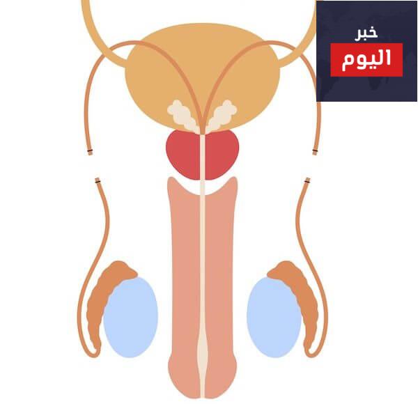 قطع القناة الدافقة - تعقيم الذكور - Vasectomy (male sterilisation)
