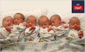 ولادة التوأم - Multiple births