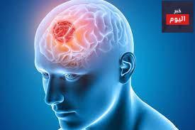 الورم الدماغي الخبيث ,سرطاني - Brain tumour, malignant (cancerous)