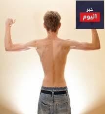 المراهقون النحيلون - Underweight teen boys