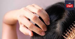 المرأة وتساقط الشعر: نصائح التعامل - Women and hair loss: coping tips