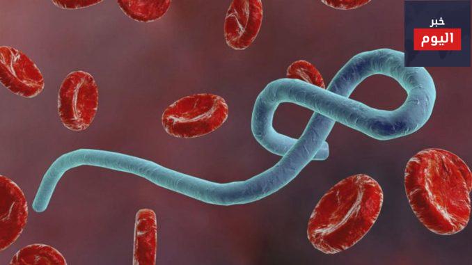 مرض فيروس إيبولا -أسئلة متكررة - Ebola virus disease- FAQ