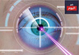 جراحة العين الليزرية - Laser eye surgery