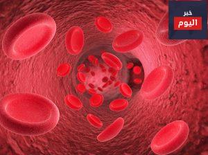 دم في السائل المنوي - Blood in semen