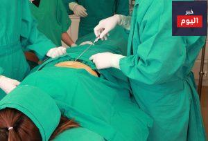 عند استخدام مصّ الشحم - When liposuction is used