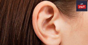 إعادة تشكيل الأذن - Ear reshaping