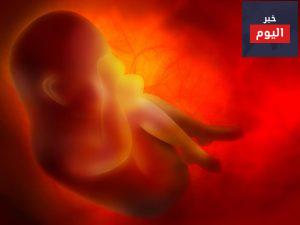ما هي أسباب زيادة السائل الأمنيوسي حول الجنين؟