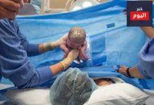 ممرضات يبتكرن ستارة تسهل احتضان الأم لرضيعها فور الولادة القيصرية