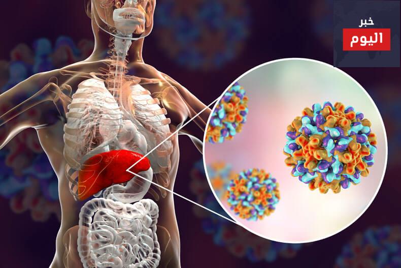 الوقاية والعلاج من التهاب الكبد الوبائي