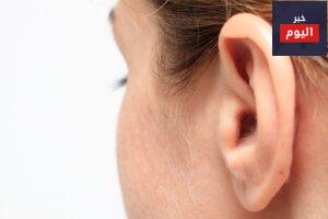 علاج ثقب طبلة الاذن