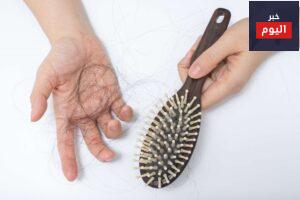 علاج تساقط الشعر بدون أدوية وبوسائل طبيعية