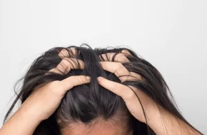 علاج تساقط الشعر والقشرة والحكة