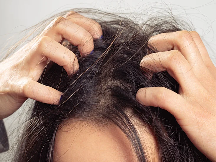 تقصف الشعر عند التاج مقدمة الراس: الأسباب وكيفية إصلاحه