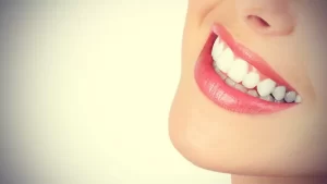 6 طرق طبيعية لتبييض الأسنان في المنزل