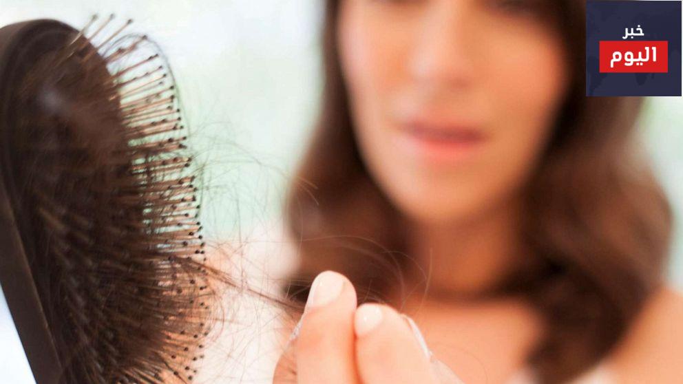 علاج تساقط الشعر نهائيا