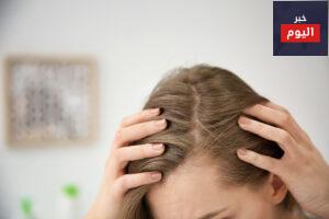 علاج تساقط الشعر للبنات